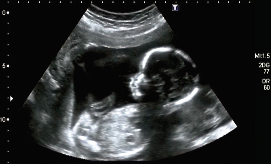 Baby in Womb